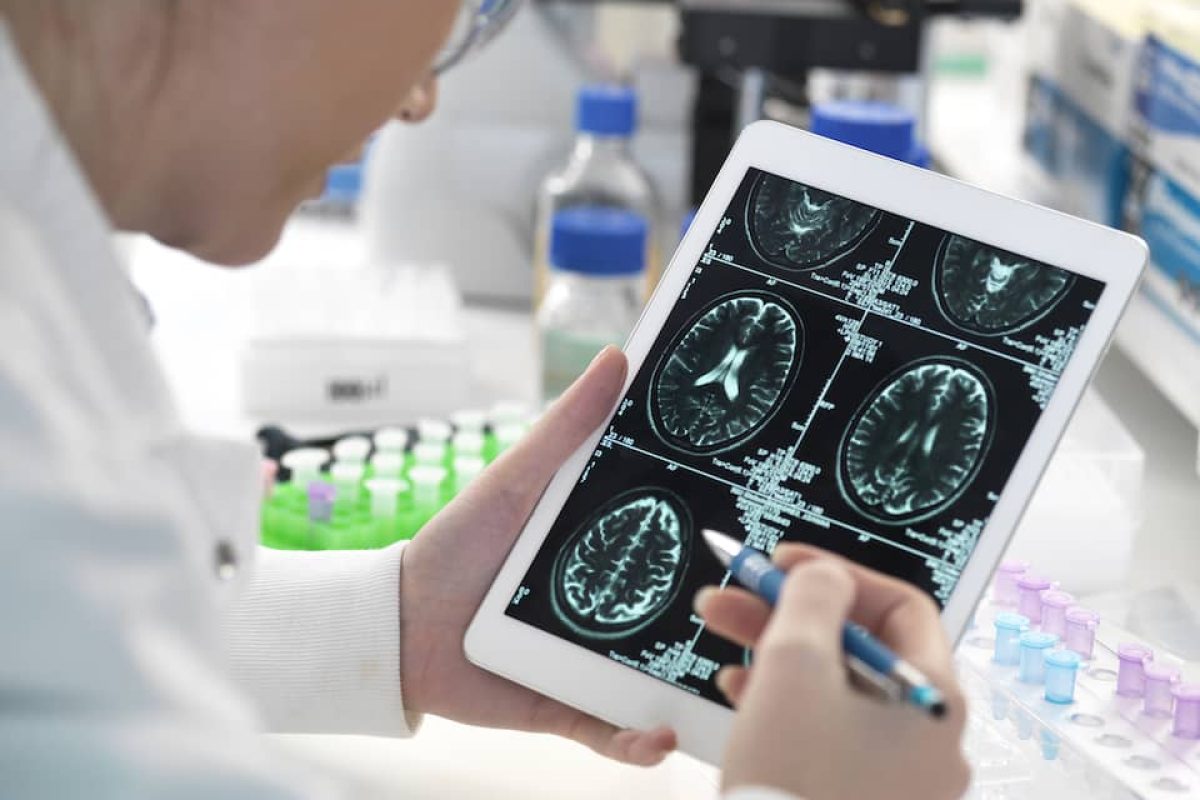brain images on tablet