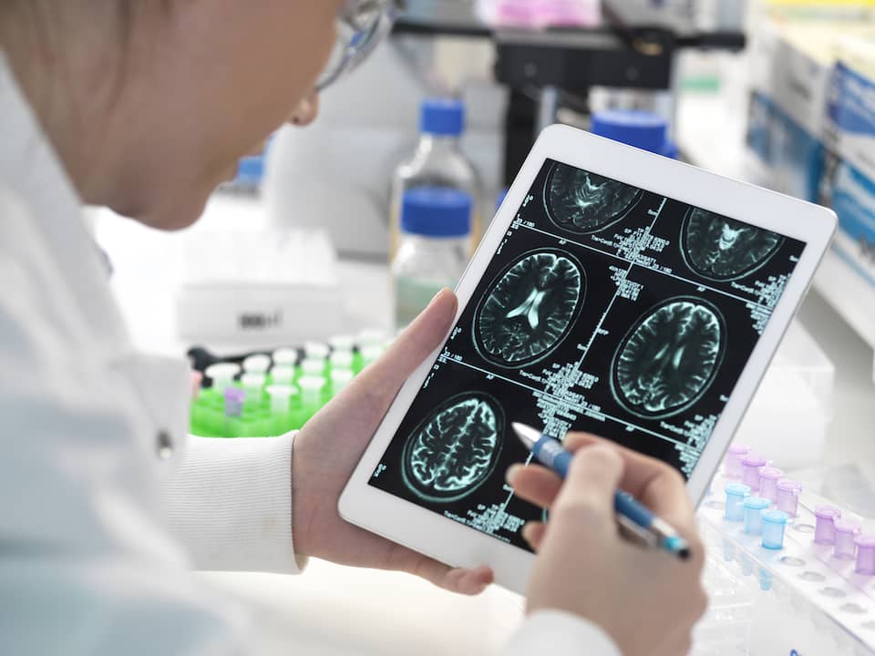 brain images on tablet